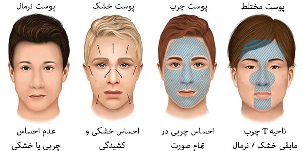 ششناخت نوع پوست